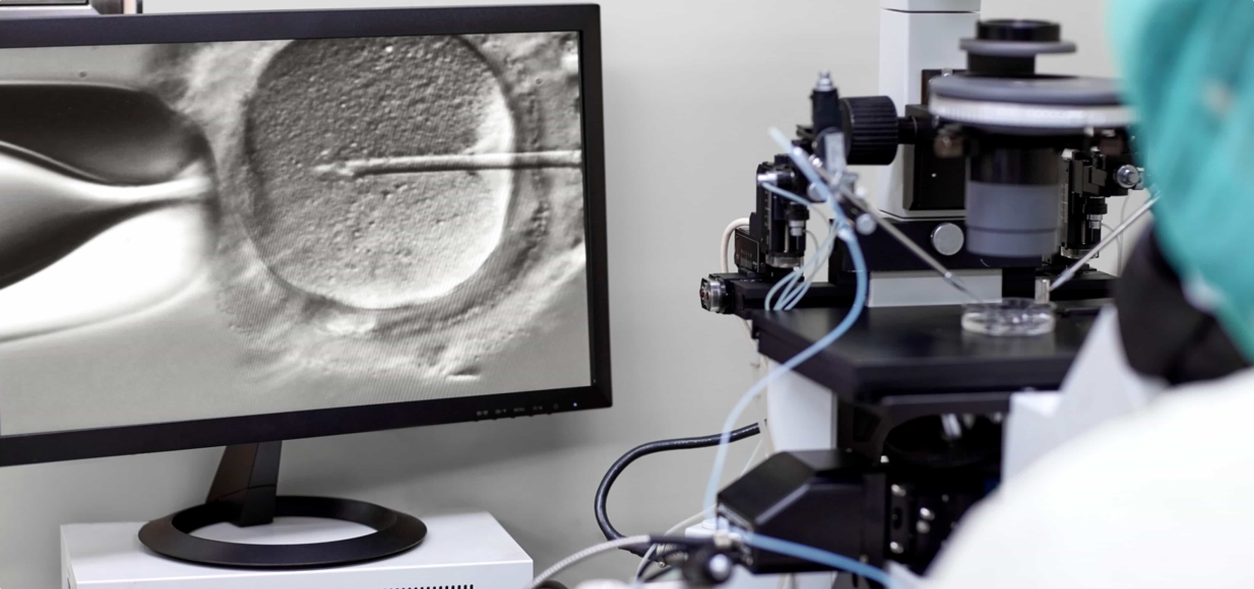 assisted conception process